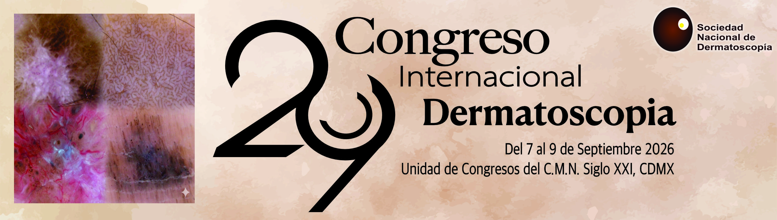 XXIX Congreso Internacional de Dermatoscopia 2026